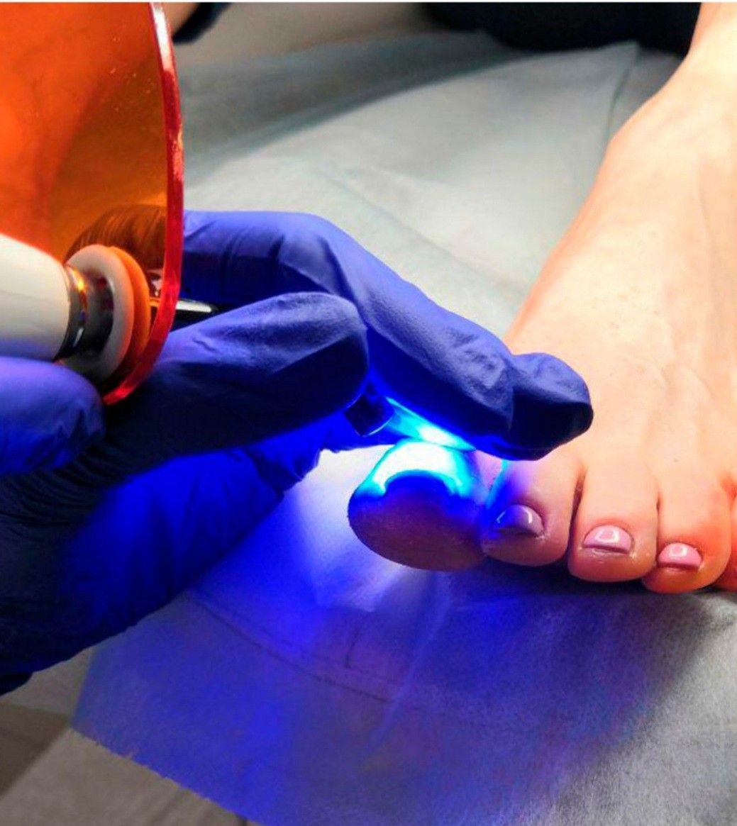 Pedicure Clínico en Santiago - Podólogo Alex Herrera Maipú